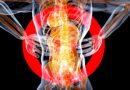 kidney disease epidemic