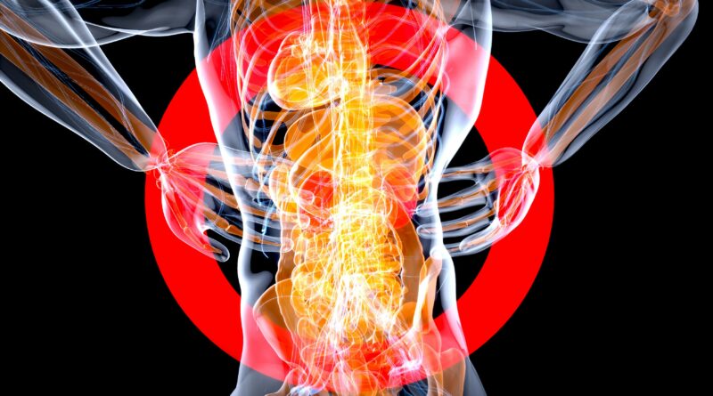 kidney disease epidemic