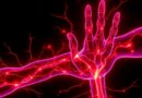 Diabetic neuropathy affects millions with diabetes. Understand its symptoms, causes, risk factors, treatment options, and foot care practices.